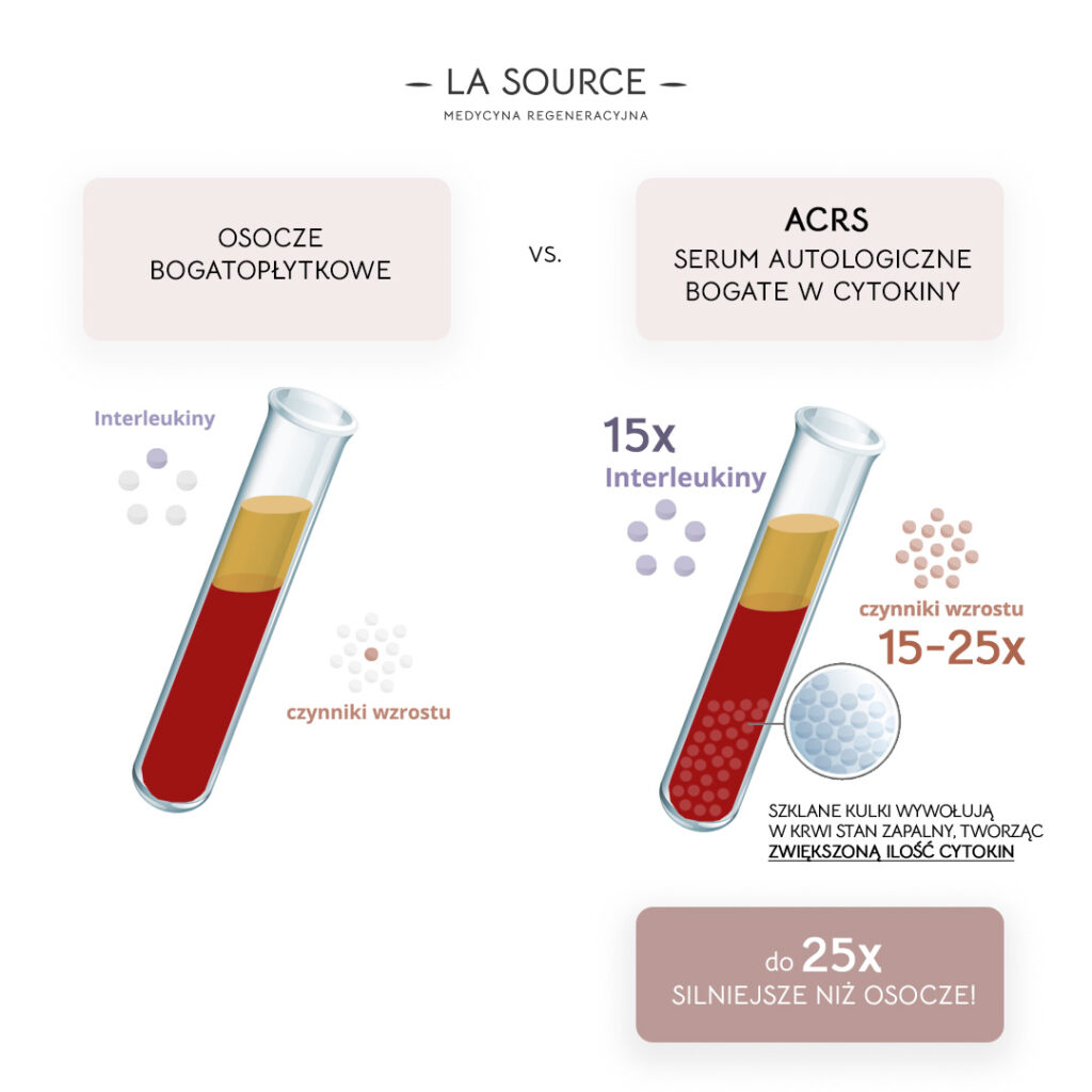 cytokinowe serum z-krwi acrs osocze bogatoplytkowe fibryna bogatoplytkowa autologiczny-wypelniacza ACRS vs PSP -
